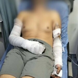 manisada sanayi sitesinde patlama 2 yarali d4xzrKRi